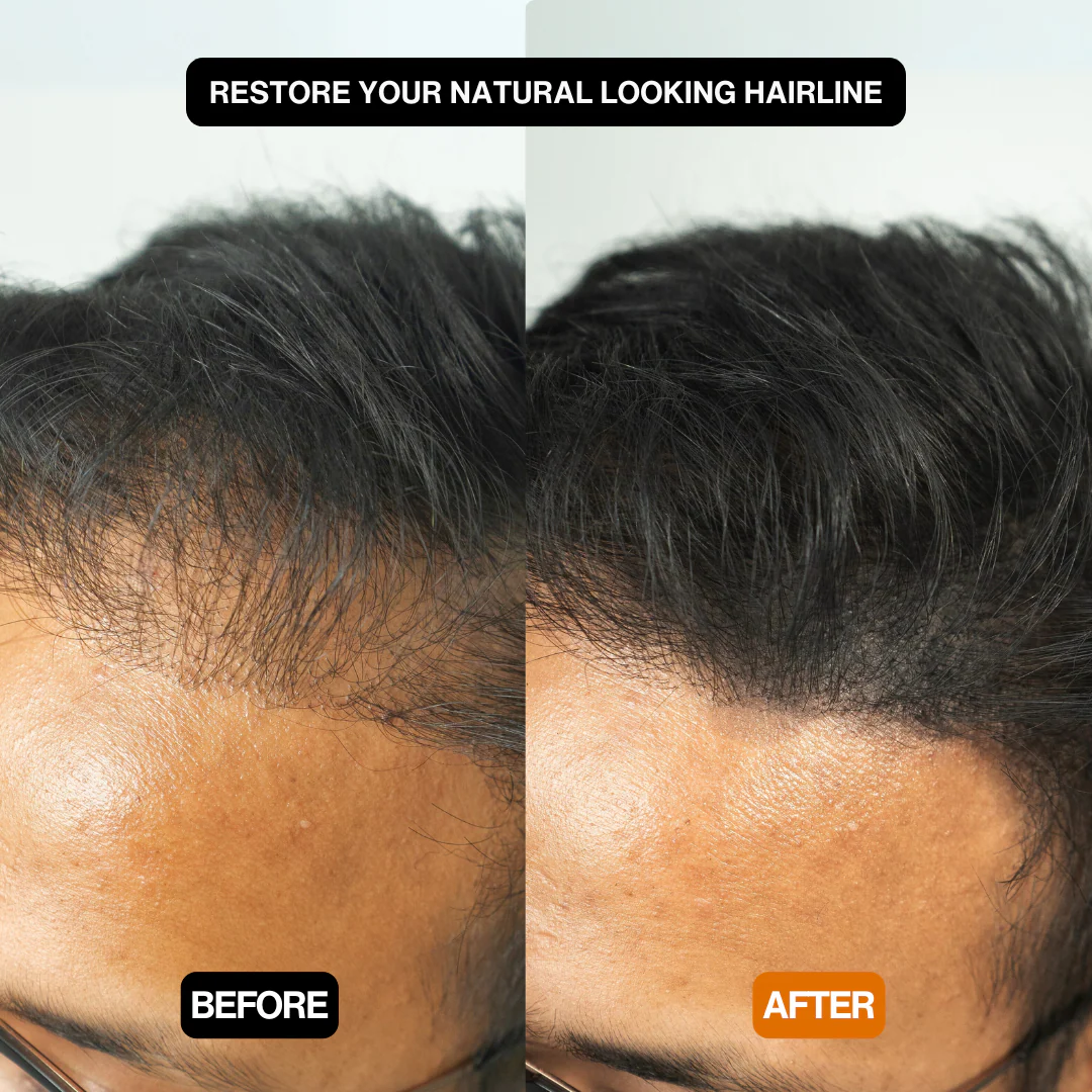 Instant Precision Hair Density Powder