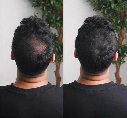 Instant Precision Hair Density Powder